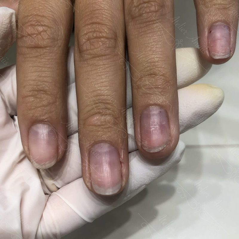 nail drill handle breakage causes material weakness design